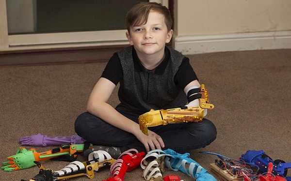 感動！英父親為無臂兒子3D打印9只個性仿生臂