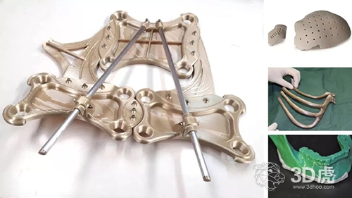 【探討】FDM 3D打印到底有沒有應(yīng)用性？(圖2)