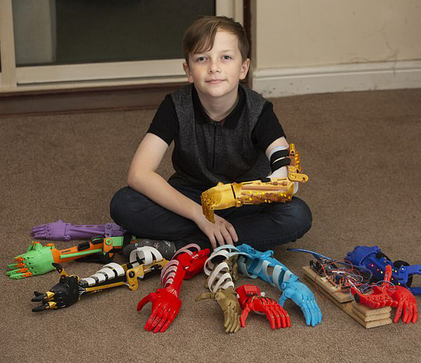 感動(dòng)！英父親為無(wú)臂兒子3D打印9只個(gè)性仿生臂(圖1)