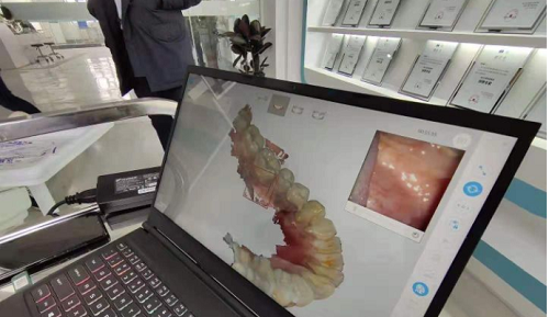  3D打印技術在牙科義齒領域中牙套制作的應用是怎樣的呢？(圖2)